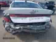 2021 Hyundai Elantra Limited with VIN 5NPLP4AGXMH035455, listed as a IAAI auction lot 42586803 with 119,963 mi miles and . Bid and sale history available at DreamBid. Image 6.