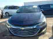 2022 Chevrolet Malibu LT z VIN 1G1ZD5STXNF123432, wystawiony jako IAAI lot #41091332 z przebiegiem 61 388 mil mil oraz . Historia ofert i sprzedaży dostępna na DreamBid. Obrazek 12.