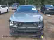 2019 Toyota Camry SE z VIN 4T1B11HK2KU688740, wystawiony jako IAAI lot #43089818 z przebiegiem 92 496 mil mil oraz . Historia ofert i sprzedaży dostępna na DreamBid. Obrazek 13.