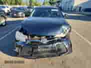 2017 Toyota Camry SE z VIN 4T1BF1FK4HU336322, wystawiony jako Copart lot #82513315 z przebiegiem 122 030 mil mil oraz Czysty tytuł • Clean title. Historia ofert i sprzedaży dostępna na DreamBid. Obrazek 5.