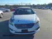 2017 Hyundai Sonata SE z VIN 5NPE24AF5HH534409, wystawiony jako IAAI lot #43306906 z przebiegiem 151 947 mil mil oraz . Historia ofert i sprzedaży dostępna na DreamBid. Obrazek 12.