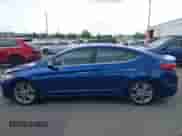 2017 Hyundai Elantra SE z VIN 5NPD84LF6HH041555, wystawiony jako IAAI lot #42277973 z przebiegiem 141 830 mil mil oraz . Historia ofert i sprzedaży dostępna na DreamBid. Obrazek 13.