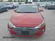 2020 Hyundai Elantra SE с VIN KMHD74LF1LU983039, выставлен на аукционе Copart как лот 81271605 с пробегом 15 420 миль миль и Списание • Salvage title. История ставок и продаж доступна на DreamBid. Изображение 5.