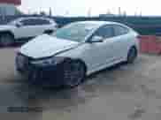 2017 Hyundai Elantra Sport with VIN KMHD04LB0HU344028, listed as a IAAI auction lot 42861838 with 73,641 mi miles and . Bid and sale history available at DreamBid. Image 19.