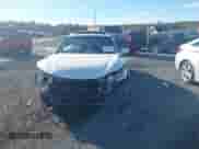 2017 Honda Accord EX-L with VIN 1HGCR3F84HA034922, listed as a IAAI auction lot 43485521 with 137,779 mi miles and . Bid and sale history available at DreamBid. Image 12.