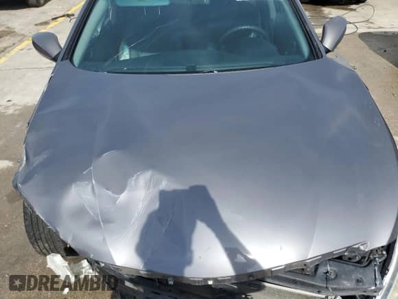 2011 Hyundai Sonata GLS с VIN 5NPEB4AC3BH176448, выставлен на аукционе Copart как лот 86835495 с пробегом Не указан миль и На запчасти • Non repairable. История ставок и продаж доступна на DreamBid. Изображение 11.