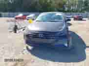 2020 Hyundai Elantra SEL z VIN 5NPD84LF1LH505702, wystawiony jako IAAI lot #43365708 z przebiegiem 23 279 mil mil oraz . Historia ofert i sprzedaży dostępna na DreamBid. Obrazek 12.