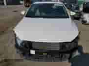 2018 Hyundai Elantra SEL с VIN 5NPD84LF2JH315386, выставлен на аукционе Copart как лот 80537785 с пробегом 100 281 миль миль и Чистый • Clean title. История ставок и продаж доступна на DreamBid. Изображение 5.