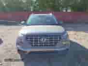 2021 Hyundai Venue SEL z VIN KMHRC8A30MU103502, wystawiony jako IAAI lot #43304546 z przebiegiem 80 046 mil mil oraz . Historia ofert i sprzedaży dostępna na DreamBid. Obrazek 12.