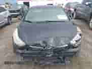 2014 Hyundai Elantra SE с VIN KMHDH4AE8EU101780, выставлен на аукционе IAAI как лот 42730864 с пробегом 119 086 миль миль и . История ставок и продаж доступна на DreamBid. Изображение 12.