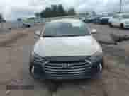 2017 Hyundai Elantra SE z VIN KMHD74LF7HU090140, wystawiony jako IAAI lot #43344449 z przebiegiem 125 156 mil mil oraz . Historia ofert i sprzedaży dostępna na DreamBid. Obrazek 12.