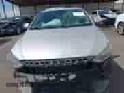 2017 Hyundai Elantra SE z VIN 5NPD84LF4HH146594, wystawiony jako IAAI lot #43242324 z przebiegiem 96 036 mil mil oraz . Historia ofert i sprzedaży dostępna na DreamBid. Obrazek 12.