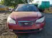 2010 Hyundai Elantra GLS с VIN KMHDU4AD2AU195782, выставлен на аукционе Copart как лот 82177905 с пробегом 117 447 миль миль и Списание • Salvage title. История ставок и продаж доступна на DreamBid. Изображение 5.