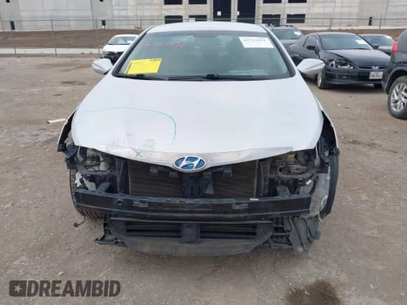 2015 Hyundai Sonata z VIN KMHEC4A42FA137994, wystawiony jako IAAI lot #42721431 z przebiegiem 151 651 mil mil oraz . Historia ofert i sprzedaży dostępna na DreamBid. Obrazek 12.