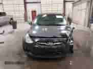 2012 Hyundai Accent GLS z VIN KMHCT4AE9CU084348, wystawiony jako IAAI lot #43230958 z przebiegiem 140 984 mil mil oraz . Historia ofert i sprzedaży dostępna na DreamBid. Obrazek 12.