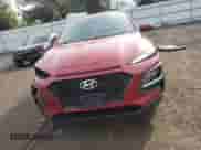 2018 Hyundai Kona SEL with VIN KM8K2CAA6JU147246, listed as a Copart auction lot 80324185 with 49,367 mi miles and Salvage title. Bid and sale history available at DreamBid. Image 5.