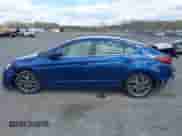 2020 Hyundai Elantra SEL z VIN 5NPD84LFXLH537113, wystawiony jako IAAI lot #42051808 z przebiegiem 41 218 mil mil oraz . Historia ofert i sprzedaży dostępna na DreamBid. Obrazek 15.