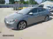 2017 Hyundai Elantra SE with VIN KMHD84LF7HU154299, listed as a Copart auction lot 63524135 with 140,132 mi miles and Salvage title. Bid and sale history available at DreamBid. Image 1.