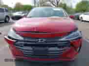 2020 Hyundai Elantra SEL с VIN KMHD84LF0LU955309, выставлен на аукционе IAAI как лот 42124043 с пробегом 79 324 миль миль и . История ставок и продаж доступна на DreamBid. Изображение 12.