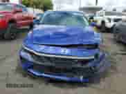 2024 Hyundai Elantra SEL с VIN KMHLM4DGXRU719967, выставлен на аукционе Copart как лот 85144775 с пробегом 9 721 миль миль и Чистый • Clean title. История ставок и продаж доступна на DreamBid. Изображение 5.