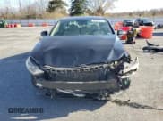 ✅ 2017 Hyundai Elantra Limited • VIN: 5NPD84LF6HH152462 • Lot: 92886025. Listed on Copart with 125,736 mi. Free auction sales archive from the USA and detailed vehicle history report at DreamBid. Image 5.