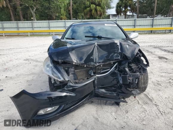 ✅ 2013 Hyundai Sonata GLS • VIN: 5NPEB4AC5DH798407 • Lot: 71415865. Listed on Copart with 119,693 mi. Free auction sales archive from the USA and detailed vehicle history report at DreamBid. Image 5.