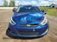 ✅ 2015 Hyundai Accent Sport • VIN: KMHCU5AE9FU204785 • Лот: 70720785. Опубликован ранее на Copart с пробегом 137 511 миль. Бесплатный доступ к архиву аукционных продаж из США и подробный отчёт об истории автомобиля на DreamBid. Изображение 5.