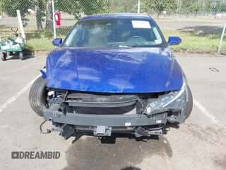 2022 Hyundai Elantra SEL с VIN KMHLN4AG4NU365584, выставлен на аукционе IAAI как лот 43114950 с пробегом 101 903 миль миль и . История ставок и продаж доступна на DreamBid. Изображение 6.