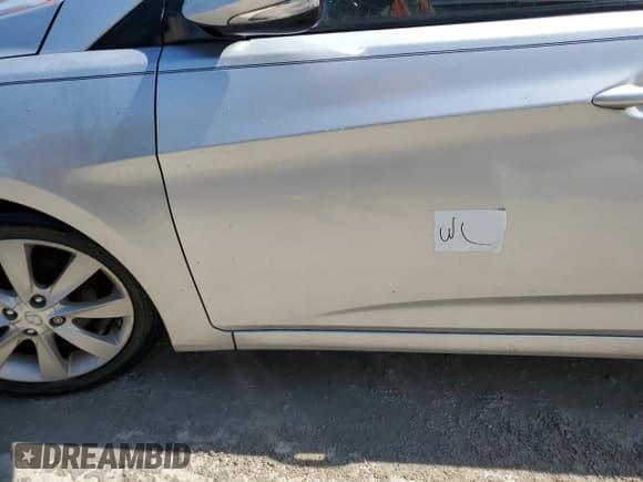 ✅ 2013 Hyundai Accent SE • VIN: KMHCU5AE8DU138582 • Лот: 75229344. Опубликован ранее на Copart с пробегом 78 923 миль. Бесплатный доступ к архиву аукционных продаж из США и подробный отчёт об истории автомобиля на DreamBid. Изображение 12.