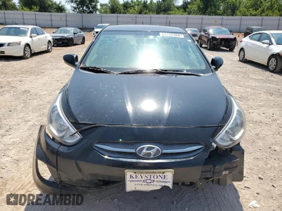 ✅ 2017 Hyundai Accent SE • VIN: KMHCT4AE6HU356393 • Лот: 69172364. Опубликован ранее на Copart с пробегом 153 744 миль. Бесплатный доступ к архиву аукционных продаж из США и подробный отчёт об истории автомобиля на DreamBid. Изображение 5.