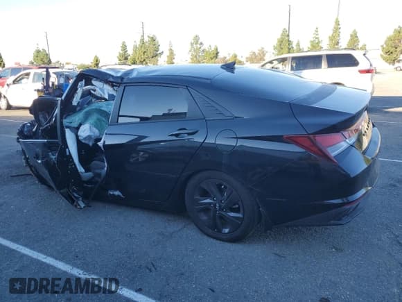 ✅ 2022 Hyundai Elantra SEL • VIN: KMHLM4AG2NU259380 • Lot: 82001515. Listed on Copart with Not provided. Free auction sales archive from the USA and detailed vehicle history report at DreamBid. Image 2.