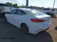 2018 Hyundai Elantra Sport with VIN KMHD04LB5JU534753, listed as a IAAI auction lot 43357697 with 62,897 mi miles and . Bid and sale history available at DreamBid. Image 3.