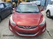 ✅ 2013 Hyundai Elantra Limited • VIN: 5NPDH4AE3DH284969 • Lot: 61418505. Listed on Copart with 151,390 mi. Free auction sales archive from the USA and detailed vehicle history report at DreamBid. Image 5.