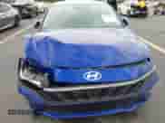 2024 Hyundai Elantra SEL z VIN KMHLM4DG5RU702252, wystawiony jako IAAI lot #43421527 z przebiegiem 18 819 mil mil oraz . Historia ofert i sprzedaży dostępna na DreamBid. Obrazek 6.