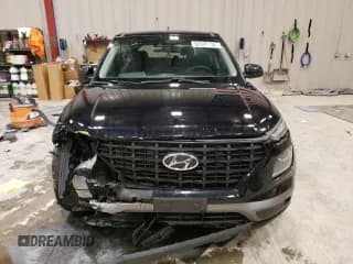 ✅ 2020 Hyundai Venue SE • VIN: KMHRB8A31LU032571 • Lot: 82027734. Listed on Copart with 101,389 mi. Free auction sales archive from the USA and detailed vehicle history report at DreamBid. Image 5.