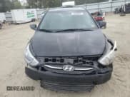 ✅ 2016 Hyundai Accent SE • VIN: KMHCT4AE1GU147285 • Лот: 79538834. Опубликован ранее на Copart с пробегом 133 679 миль. Бесплатный доступ к архиву аукционных продаж из США и подробный отчёт об истории автомобиля на DreamBid. Изображение 5.