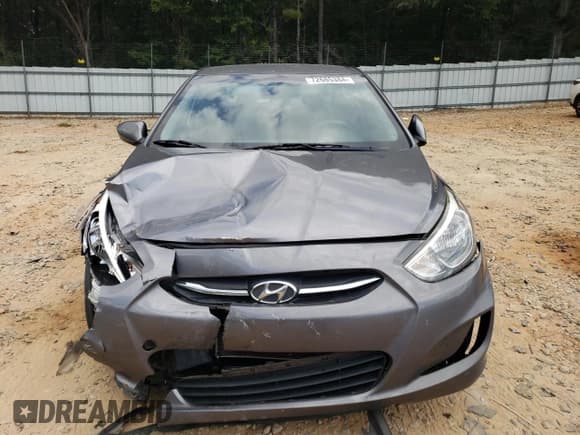 ✅ 2015 Hyundai Accent GLS • VIN: KMHCT4AE1FU913806 • Лот: 72685384. Опубликован ранее на Copart с пробегом 100 968 миль. Бесплатный доступ к архиву аукционных продаж из США и подробный отчёт об истории автомобиля на DreamBid. Изображение 5.