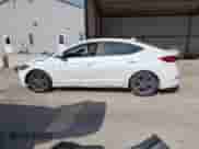 2018 Hyundai Elantra SEL z VIN 5NPD84LF9JH291801, wystawiony jako IAAI lot #43436156 z przebiegiem 81 241 mil mil oraz . Historia ofert i sprzedaży dostępna na DreamBid. Obrazek 14.