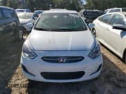 ✅ 2017 Hyundai Accent SE • VIN: KMHCT4AE6HU353008 • Лот: 80105824. Опубликован ранее на Copart с пробегом 84 533 миль. Бесплатный доступ к архиву аукционных продаж из США и подробный отчёт об истории автомобиля на DreamBid. Изображение 5.