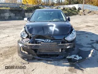 ✅ 2013 Hyundai Accent SE • VIN: KMHCU5AE6DU106228 • Лот: 78161704. Опубликован ранее на Copart с пробегом 137 780 миль. Бесплатный доступ к архиву аукционных продаж из США и подробный отчёт об истории автомобиля на DreamBid. Изображение 5.