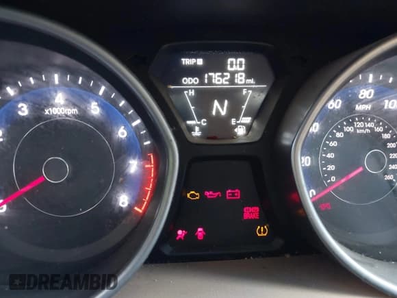 ✅ 2011 Hyundai Elantra GLS • VIN: 5NPDH4AE0BH060393 • Lot: 43578073. Listed on IAAI with 176,218 mi. Free auction sales archive from the USA and detailed vehicle history report at DreamBid. Image 7.