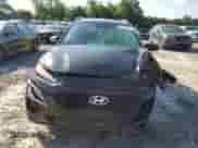 2018 Hyundai Kona SEL z VIN KM8K2CAA6JU101531, wystawiony jako Copart lot #61811773 z przebiegiem 48 690 mil mil oraz . Historia ofert i sprzedaży dostępna na DreamBid. Obrazek 5.