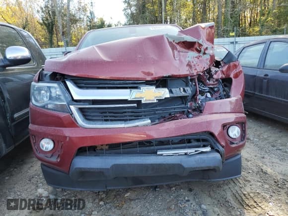 ✅ 2018 Chevrolet Colorado 2WD LT • VIN: 1GCGSCEN7J1159818 • Лот: 78494134. Опубликован ранее на Copart с пробегом 98 413 миль. Бесплатный доступ к архиву аукционных продаж из США и подробный отчёт об истории автомобиля на DreamBid. Изображение 5.