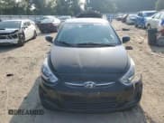 ✅ 2016 Hyundai Accent SE • VIN: KMHCT4AE6GU077170 • Лот: 69206184. Опубликован ранее на Copart с пробегом 168 679 миль. Бесплатный доступ к архиву аукционных продаж из США и подробный отчёт об истории автомобиля на DreamBid. Изображение 5.