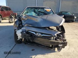 ✅ 2013 Hyundai Accent SE • VIN: KMHCU5AE5DU109685 • Лот: 60075204. Опубликован ранее на Copart с пробегом Не указан. Бесплатный доступ к архиву аукционных продаж из США и подробный отчёт об истории автомобиля на DreamBid. Изображение 5.