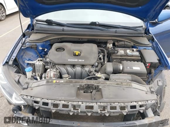 ✅ 2017 Hyundai Elantra Limited • VIN: 5NPD84LF9HH138314 • Lot: 43168932. Listed on IAAI with 90,140 mi. Free auction sales archive from the USA and detailed vehicle history report at DreamBid. Image 10.