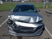 ✅ 2021 Hyundai Elantra SEL • VIN: 5NPLM4AG7MH045014 • Lot: 43345253. Listed on IAAI with 131,971 mi. Free auction sales archive from the USA and detailed vehicle history report at DreamBid. Image 6.