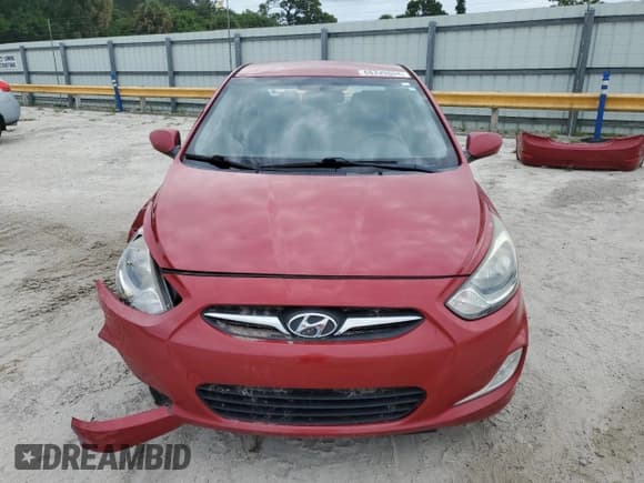 ✅ 2013 Hyundai Accent GLS • VIN: KMHCU4AE5DU462499 • Лот: 68339804. Опубликован ранее на Copart с пробегом 104 780 миль. Бесплатный доступ к архиву аукционных продаж из США и подробный отчёт об истории автомобиля на DreamBid. Изображение 5.