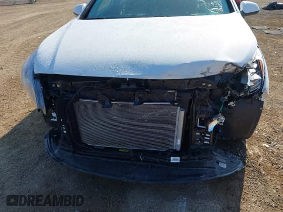 ✅ 2017 Hyundai Sonata 2.4L • VIN: 5NPE24AF0HH589057 • Лот: 43441093. Опубликован ранее на IAAI с пробегом 34 111 миль. Бесплатный доступ к архиву аукционных продаж из США и подробный отчёт об истории автомобиля на DreamBid. Изображение 6.