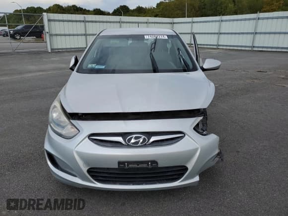 ✅ 2013 Hyundai Accent GLS • VIN: KMHCT4AE8DU364277 • Лот: 74287214. Опубликован ранее на Copart с пробегом 77 090 миль. Бесплатный доступ к архиву аукционных продаж из США и подробный отчёт об истории автомобиля на DreamBid. Изображение 5.